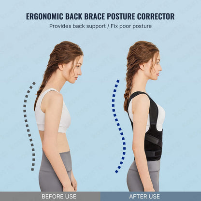Adjustable Back Shoulder Posture Corrector - (IMPORTED)